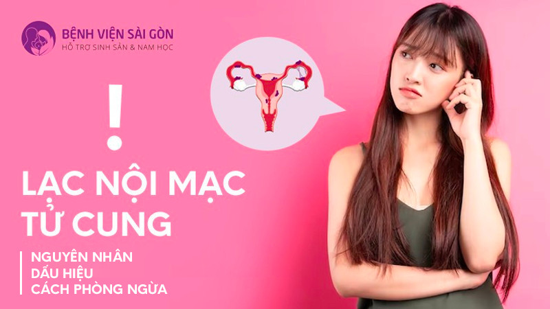 Lạc nội mạc tử cung và những điều cần lưu ý