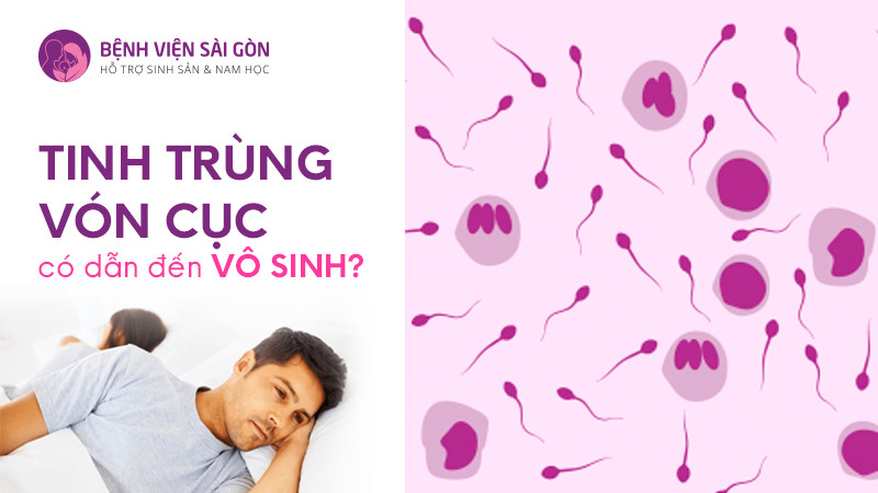 Tinh trùng vón cục