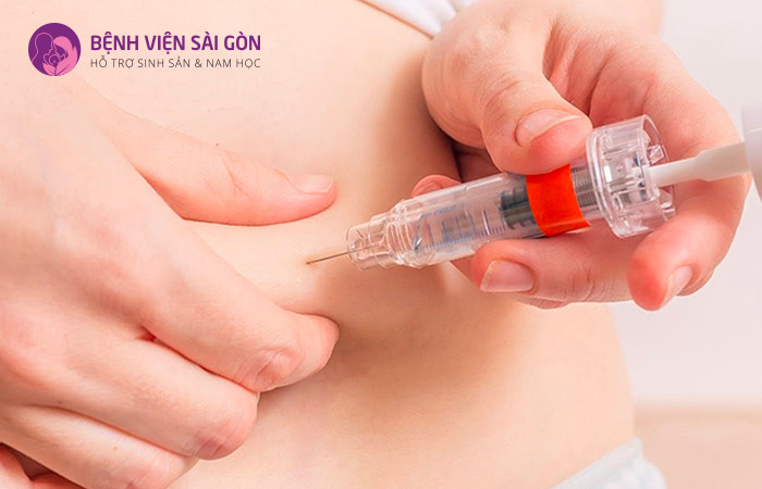 Tiêm kích trứng là một trong những bước quan trọng trong IUI Tiêm kích trứng là một trong những bước quan trọng trong IUI