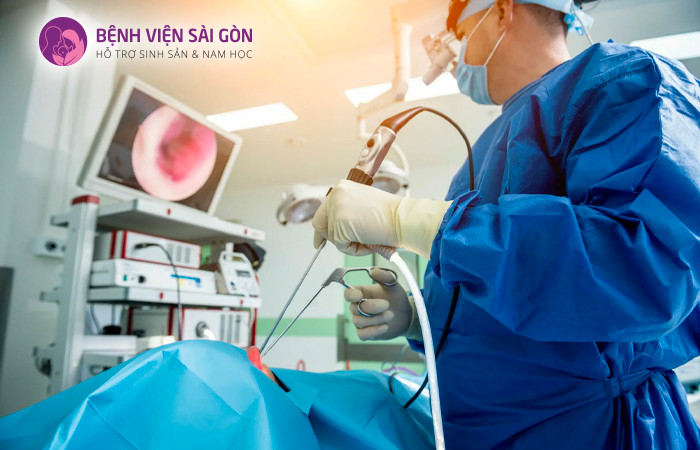 Có thể sử dụng phương pháp phẫu thuật nội soi để điều trị u xơ tử cung
