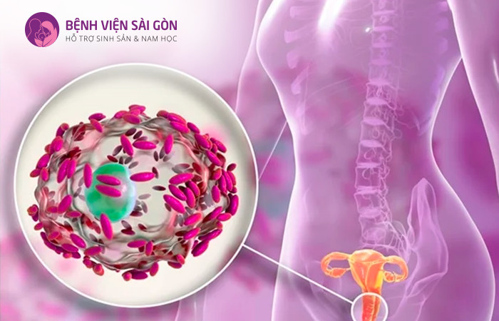 Viêm âm đạo do vi khuẩn là tình trạng phổ biến ở nữ giới