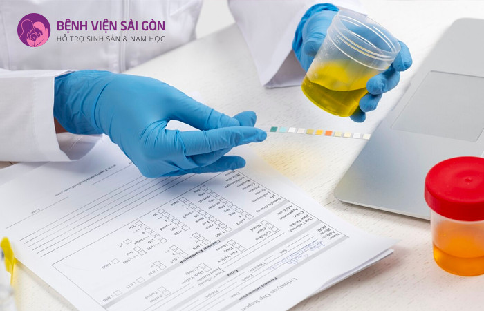 Xét nghiệm nước tiểu là phương pháp y tế hiện đại được sử dụng để chẩn đoán tình trạng bệnh lý