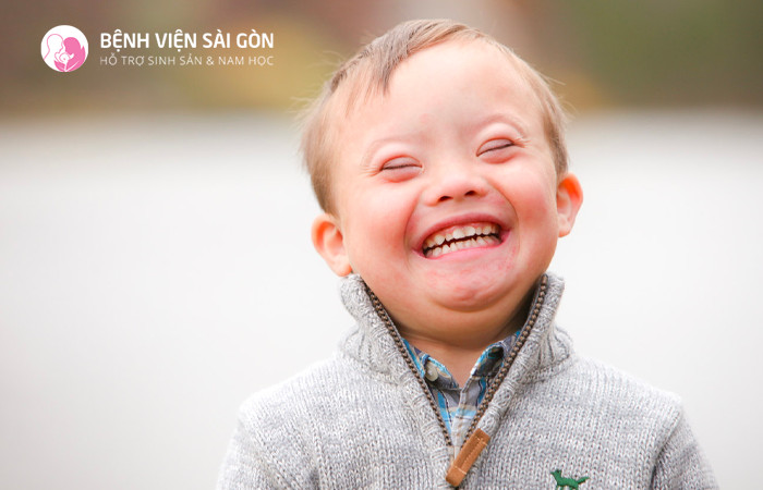 Tam nhiễm sắc thể 21 là loại phổ biến nhất