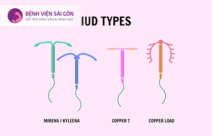 Nữ giới đặt dụng cụ ngừa thai cũng có nguy cơ bị viêm vùng chậu
