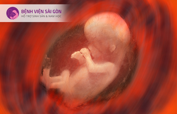 Nhau thai bị bóc tách dễ gây ra tình trạng thai chết lưu