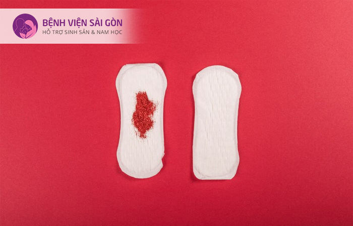Máu kinh có màu nâu hoặc đỏ sẫm cho thể là do sẩy thai hoặc thai ngoài tử cung,...