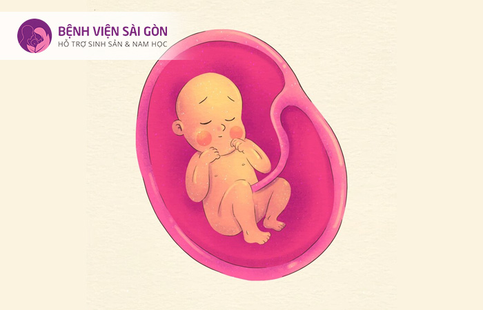 Người mẹ bị tiền sản giật có thể dẫn đến việc sinh con sớm
