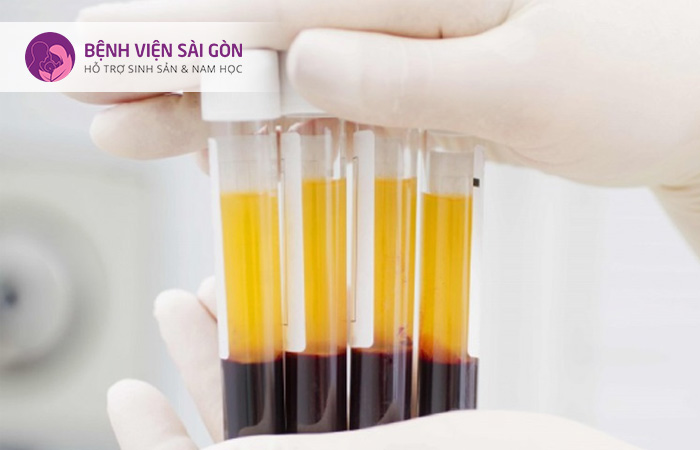 Phương pháp PRP được áp dụng trong trường hợp điều trị niêm mạc tử cung mỏng