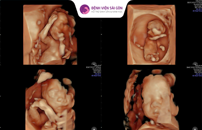Rất nhiều ba mẹ đã tìm con thành công tại Bệnh Viện Hỗ Trợ Sinh Sản & Nam Học Sài Gòn