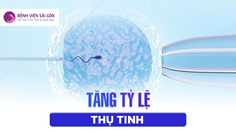 Piezo ICSI giúp cải thiện đáng kể tỷ lệ thụ tinh so với ICSI thông thường Piezo ICSI giúp cải thiện đáng kể tỷ lệ thụ tinh so với ICSI thông thường