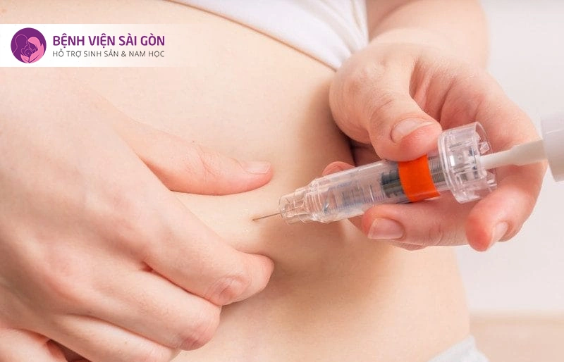 Chi phí chọc hút trứng Chi phí chọc hút trứng