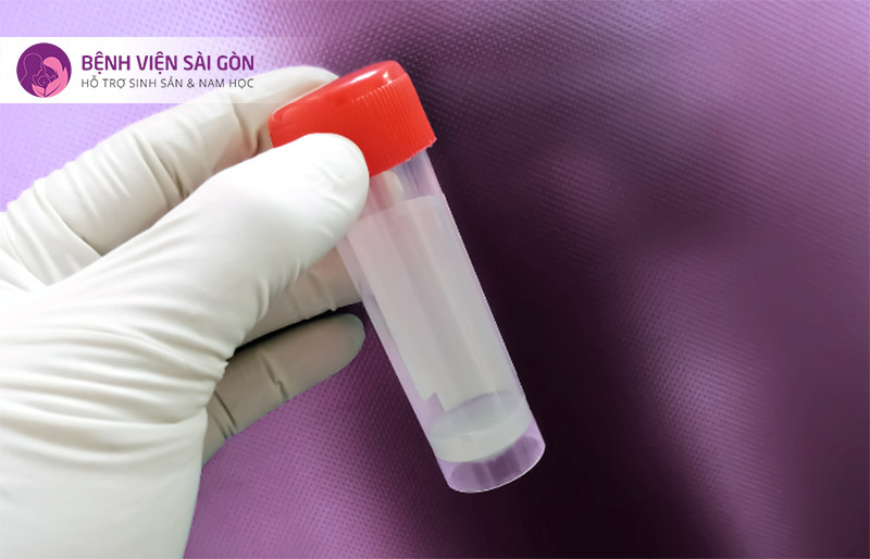 Bất thường trong xuất tinh hoặc chất lượng tinh dịch Bất thường trong xuất tinh hoặc chất lượng tinh dịch