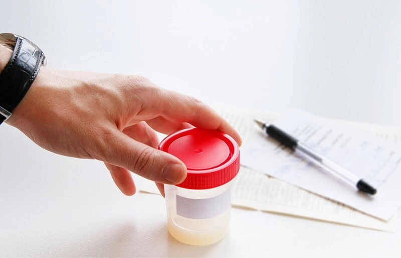 Xét nghiệm tinh dịch Khám vô sinh ở nam giới