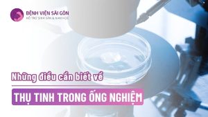 những điều cần biết về thụ tinh trong ống nghiệm