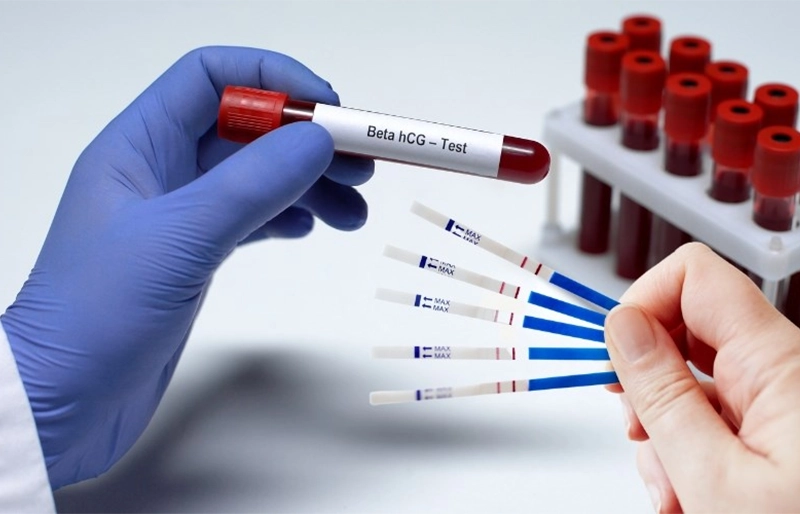 xét nghiệm máu beta-hCG xét nghiệm máu beta-hCG